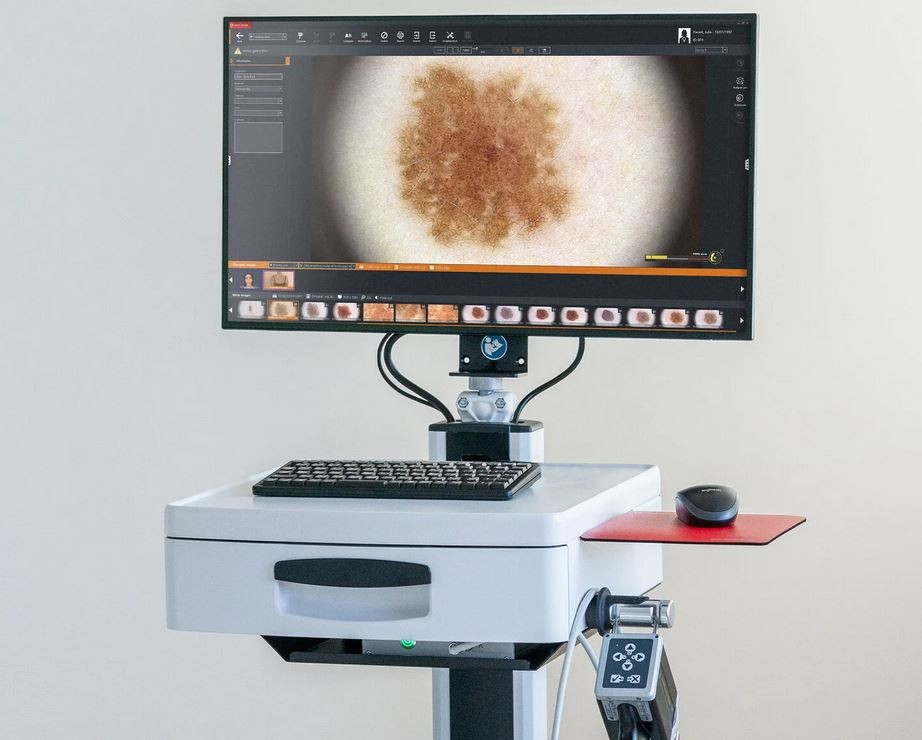 videodermatoscopio computerizzato digitale presso centro medico buonarroti