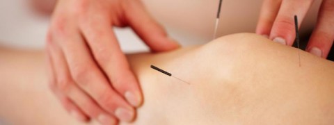 agopuntura milano, curarsi con l'agopuntura