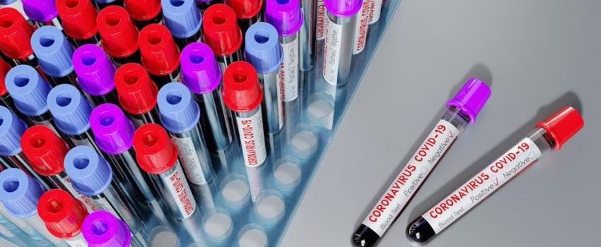esami del sangue donna sotto i 40 anni