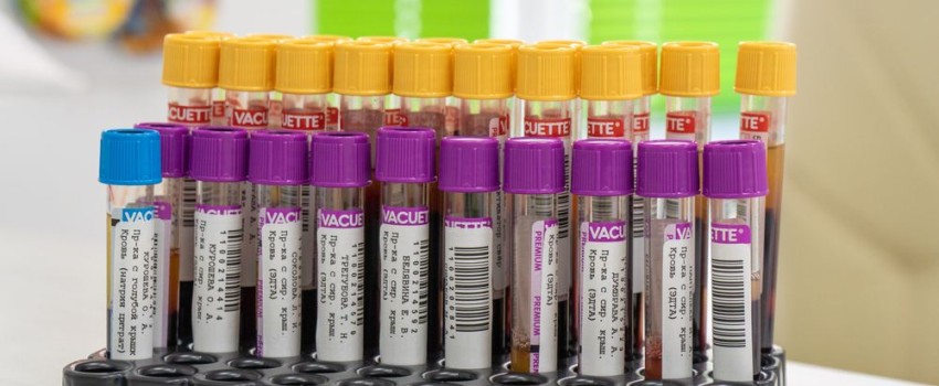 esami del sangue uomo sopra i 40 anni