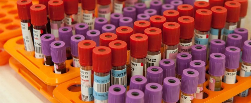 esami ematici per la tiroide milano centro medico buonarroti