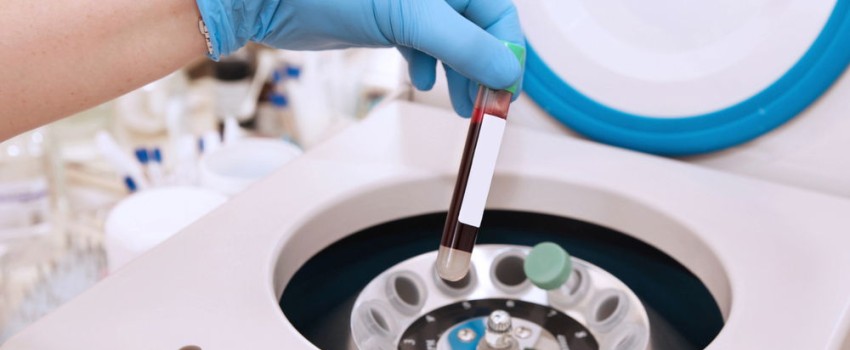 esami del sangue per osteoporosi centro medico buonarroti