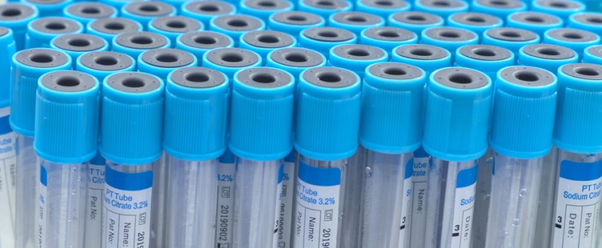 esami del sangue uomo sotto i 40 anni