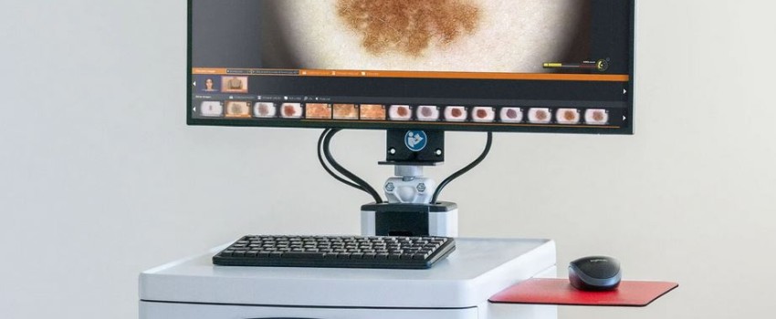 videodermatoscopio computerizzato digitale presso centro medico buonarroti