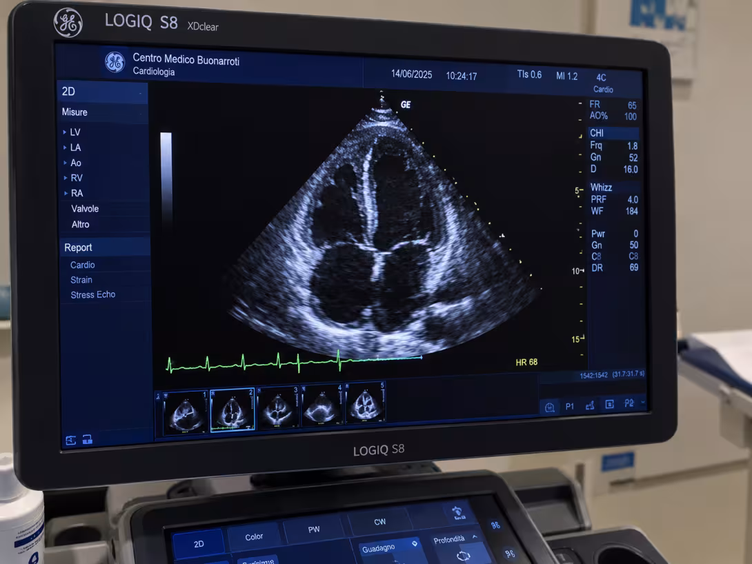 ecocardiogramma presso centro medico buonarroti